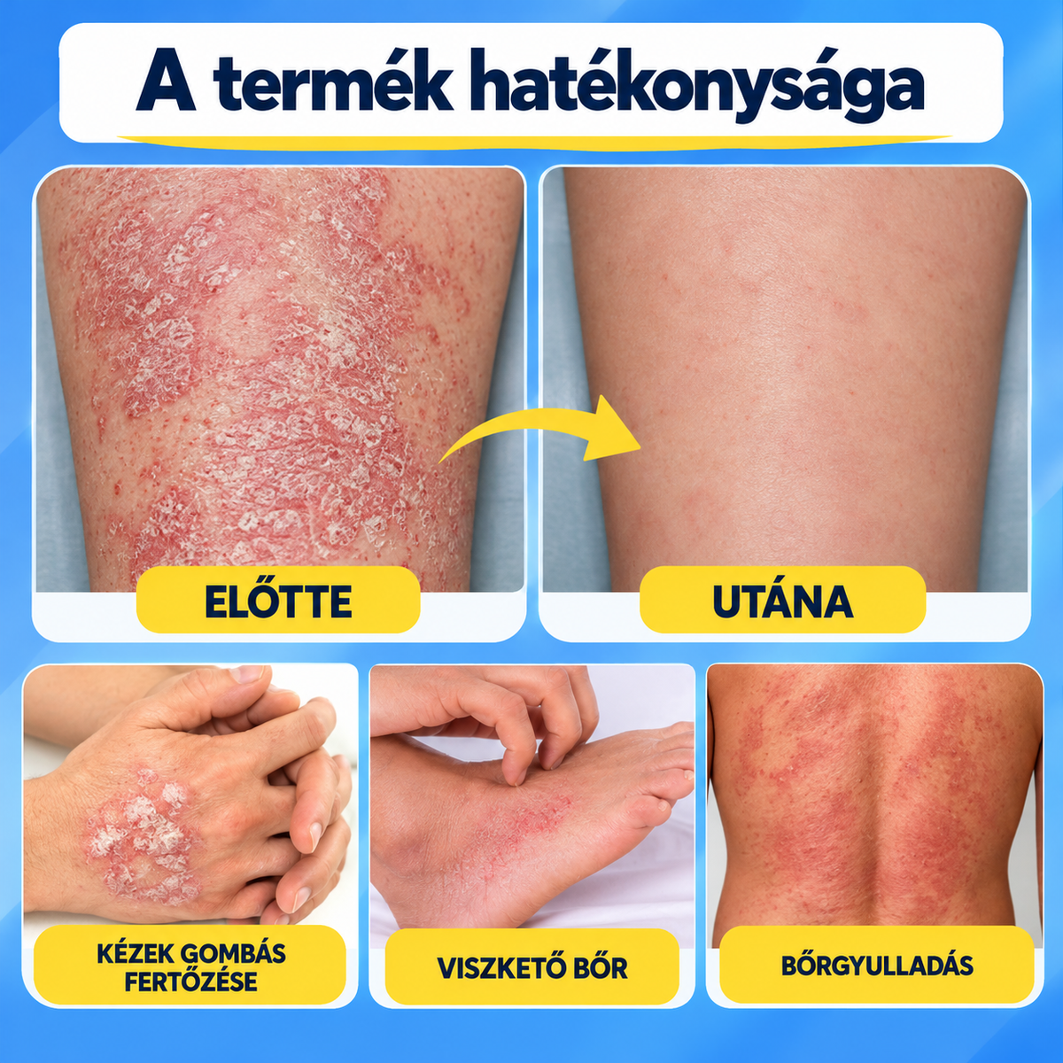 BeeCalm™ – Bőrnyugtató Spray