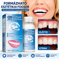 DentalKIT ProSmile™ – Formázható esztétikai fogsor