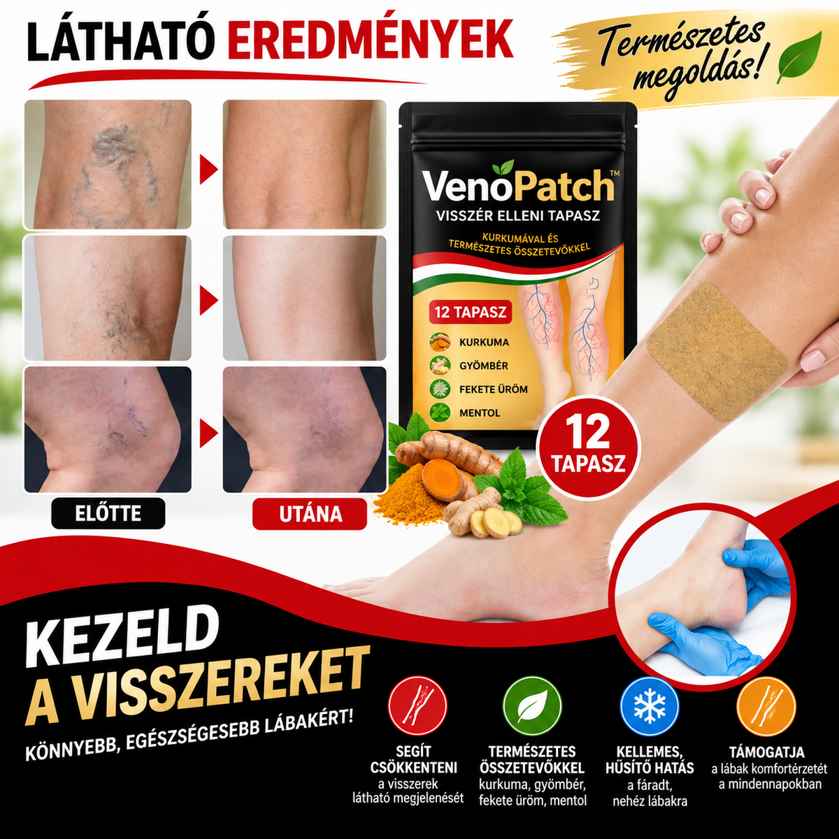 VenoPatch™ – Kurkumás tapasz visszeres lábak ápolására