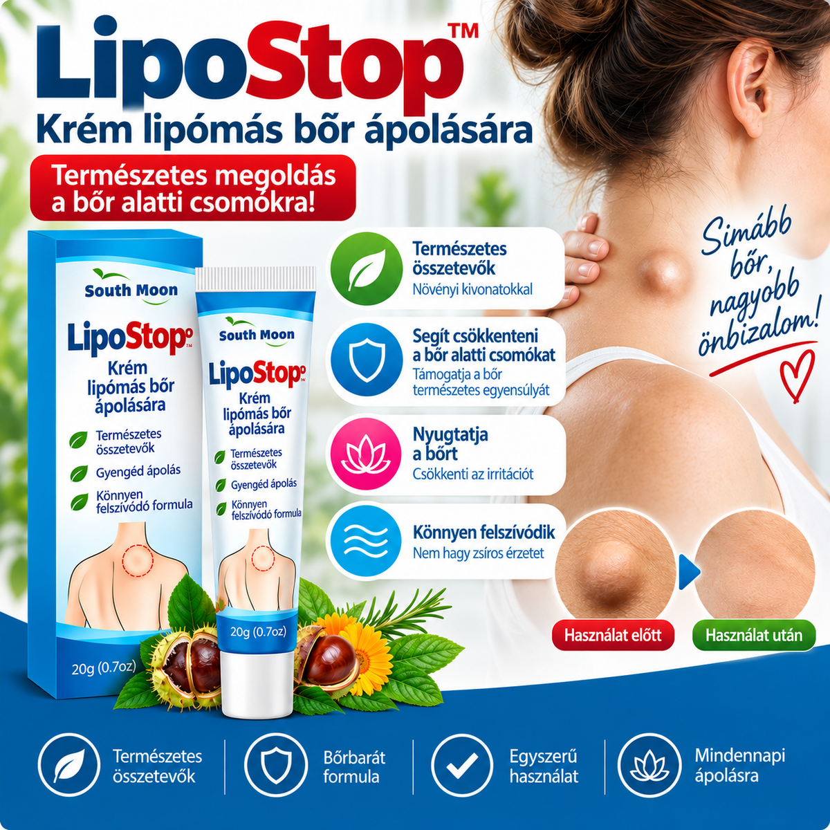 LipoStop™ – Krém lipómás bőr ápolására