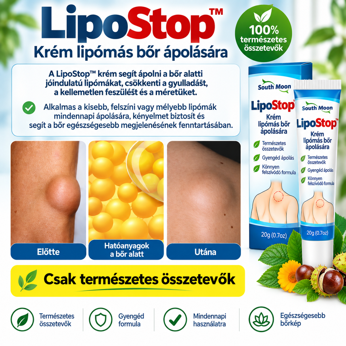 LipoStop™ – Krém lipómás bőr ápolására