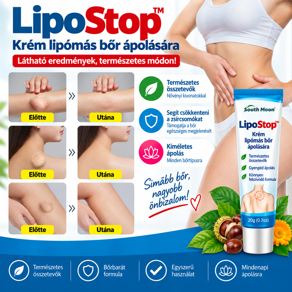 LipoStop™ – Krém lipómás bőr ápolására