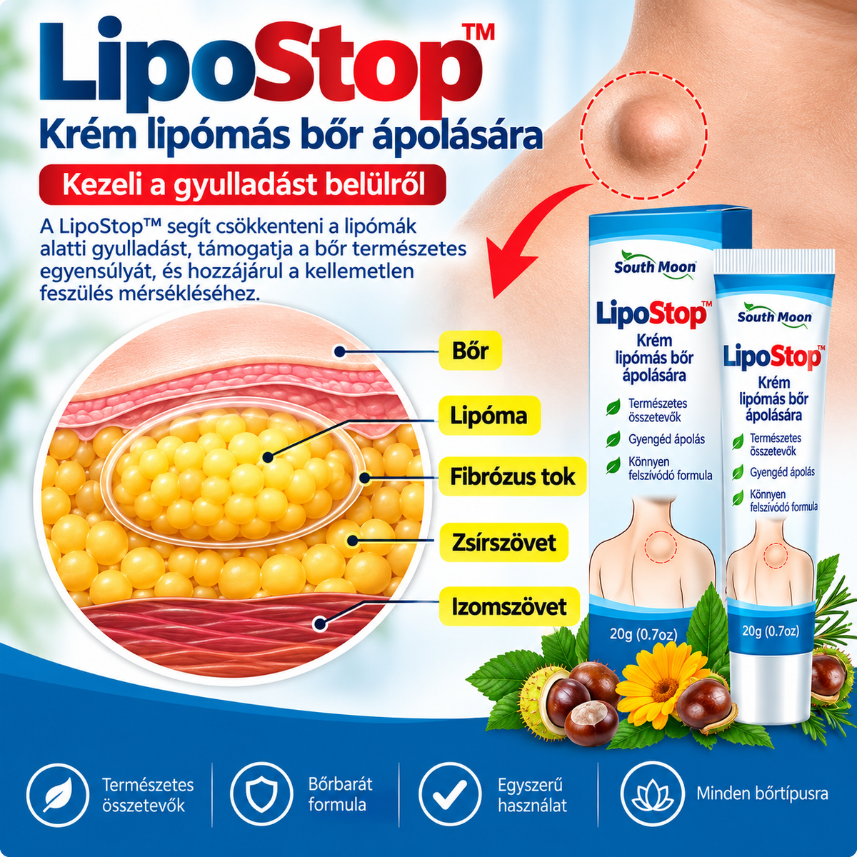 LipoStop™ – Krém lipómás bőr ápolására