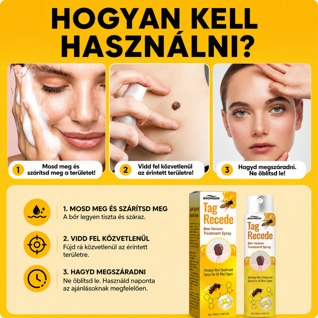 ApiDerm™ – Spray szemölcsök és papillómák ellen