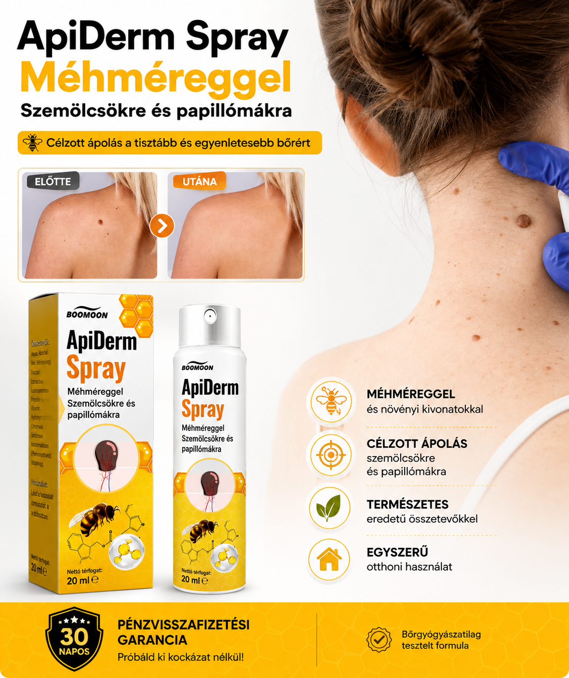 ApiDerm™ – Spray szemölcsök és papillómák ellen