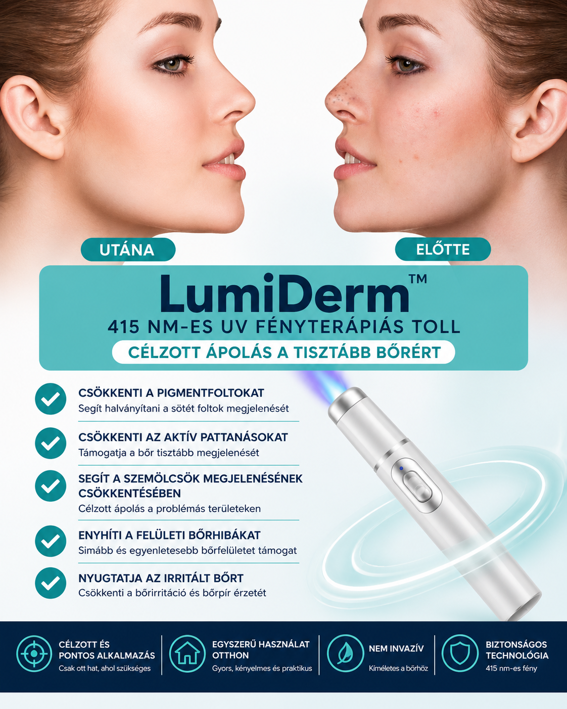 LumiDerm™ – Fényterápiás Toll Szemölcsökre