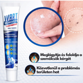WartRemover – Szemölcs és bőrkeményedés elleni krém