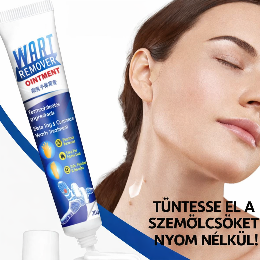 WartRemover – Szemölcs és bőrkeményedés elleni krém