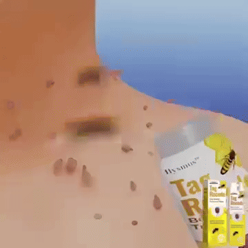 ApiDerm™ – Spray szemölcsök és papillómák ellen