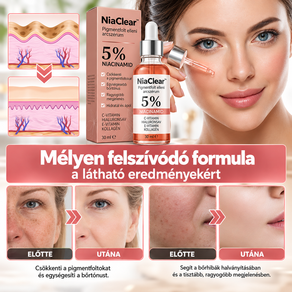 NiaClear™ – Pigmentfolt elleni arcszérum