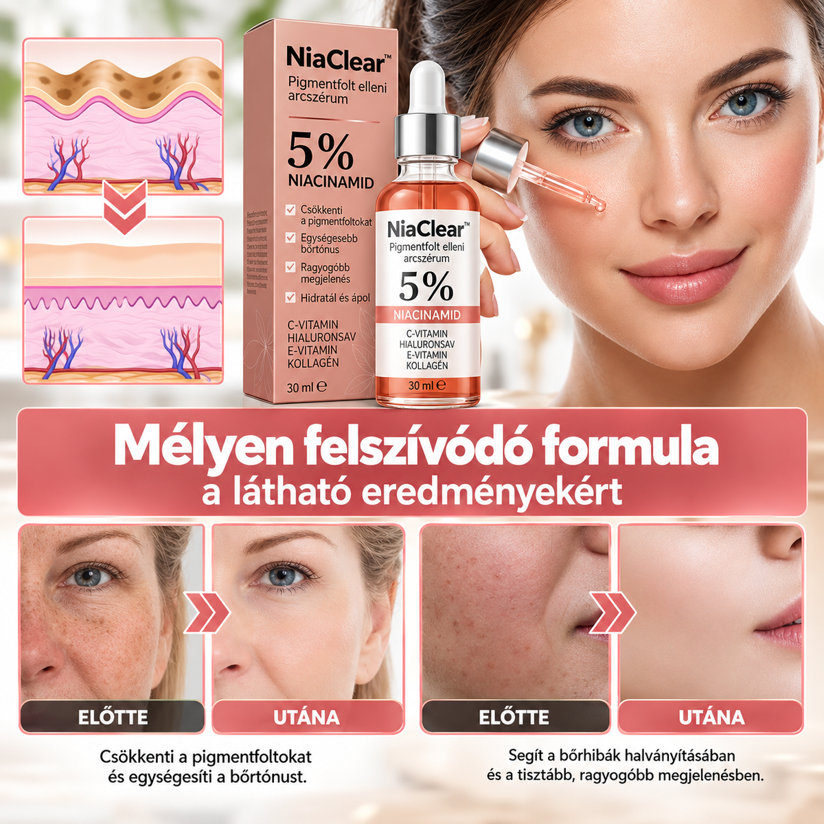 NiaClear™ – Pigmentfolt elleni arcszérum