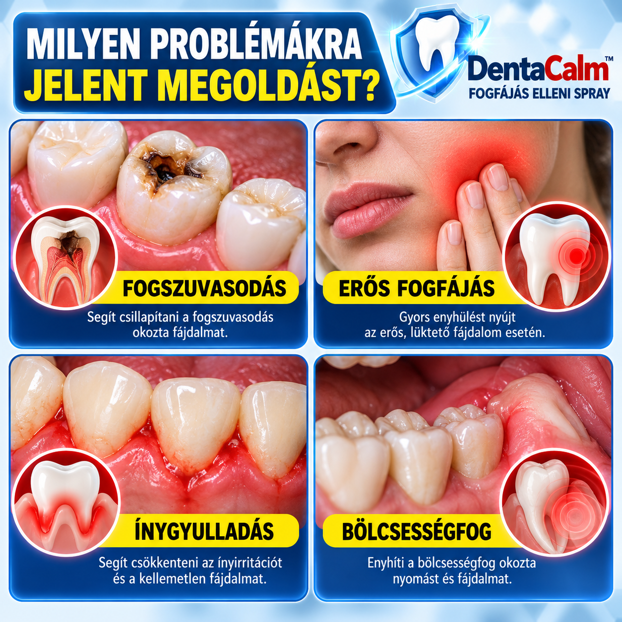 🦷 DentaCalm™ – Fogfájás elleni spray