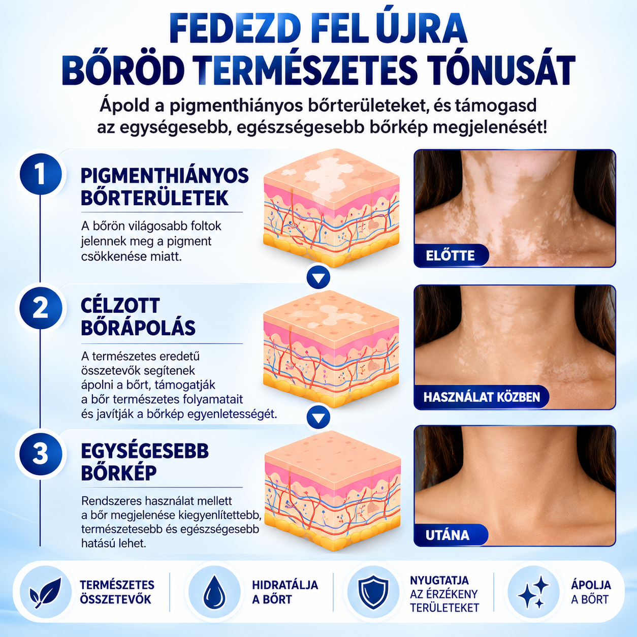 VitiDerm™ – Vitiligo bőrápoló spray
