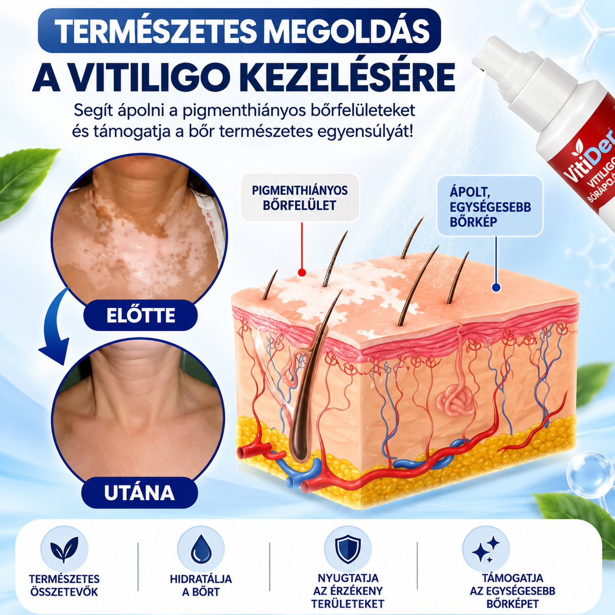 VitiDerm™ – Vitiligo bőrápoló spray