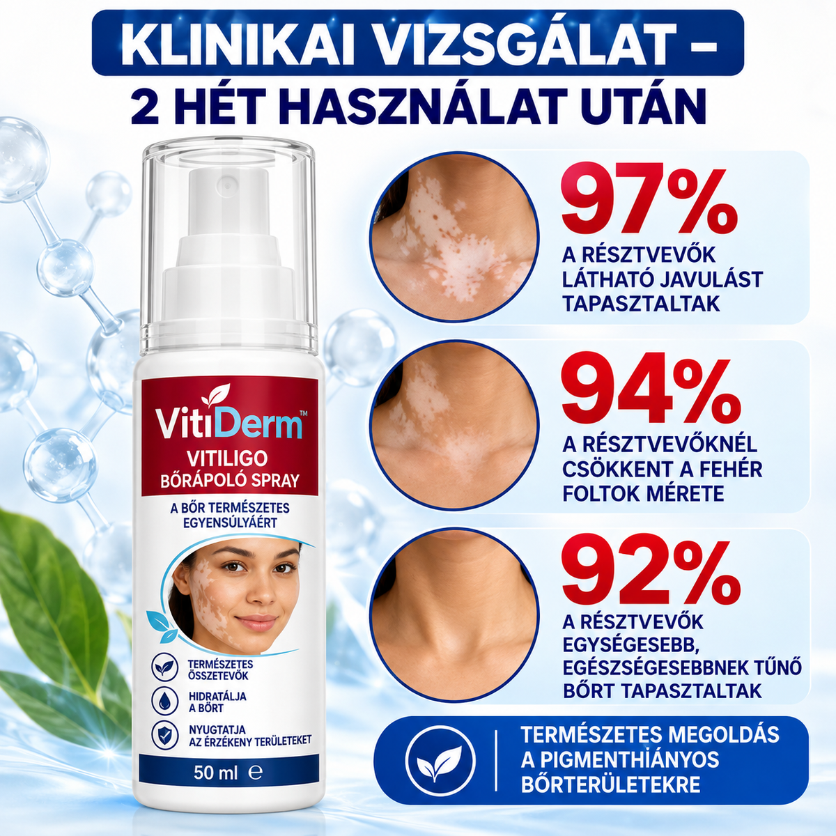 VitiDerm™ – Vitiligo bőrápoló spray