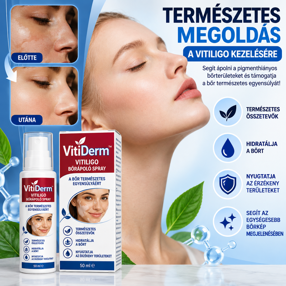 VitiDerm™ – Vitiligo bőrápoló spray
