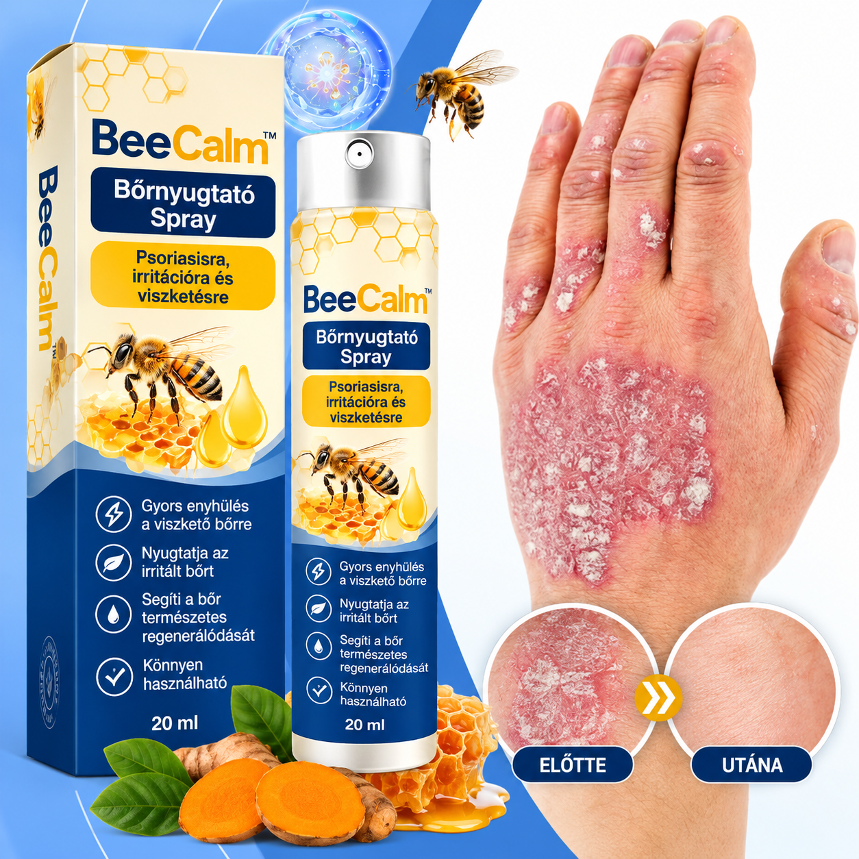 BeeCalm™ – Bőrnyugtató Spray