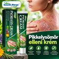 PsoriaCalm™ – Pikkelysömör elleni krém
