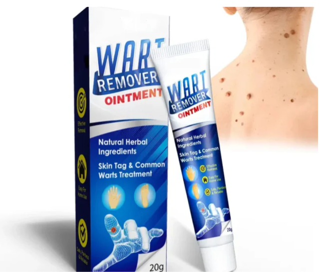 WartRemover – Szemölcs és bőrkeményedés elleni krém