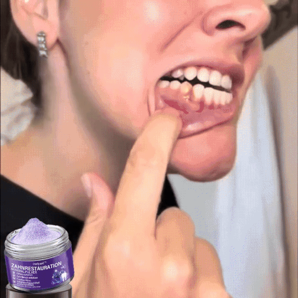 PurpleDent™ – Fogfehérítő por