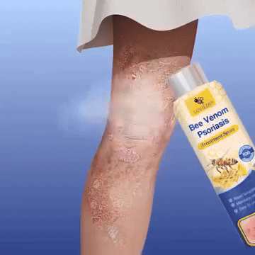 BeeCalm™ – Bőrnyugtató Spray
